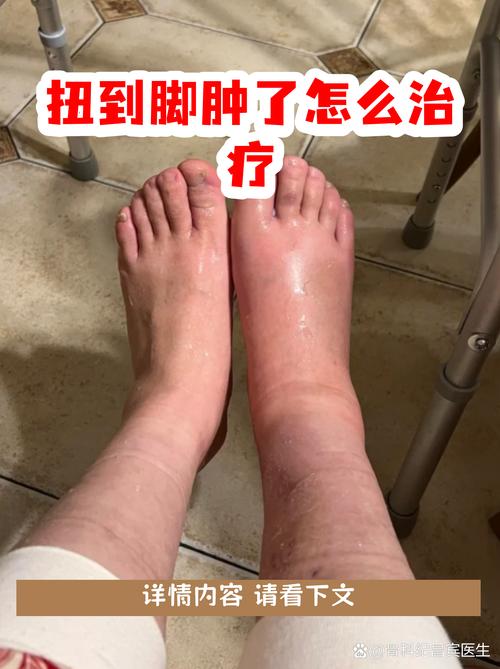 脚痛风水肿可以用热水敷治疗吗？