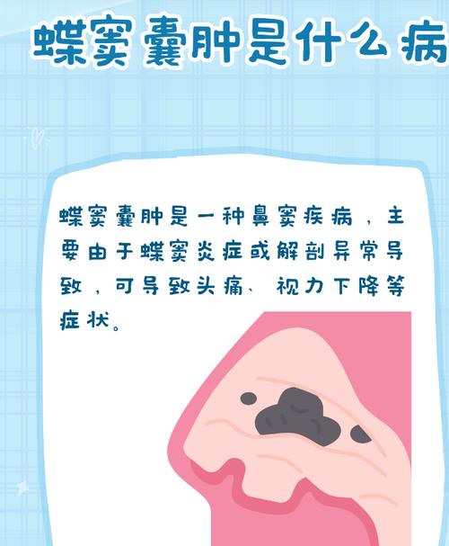 家里长囊肿和头疼与风水有关吗？