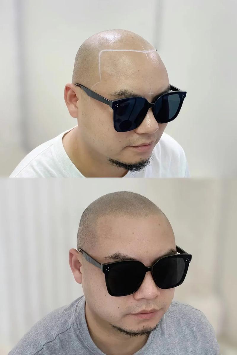 纹发际线对家居风水有影响吗？