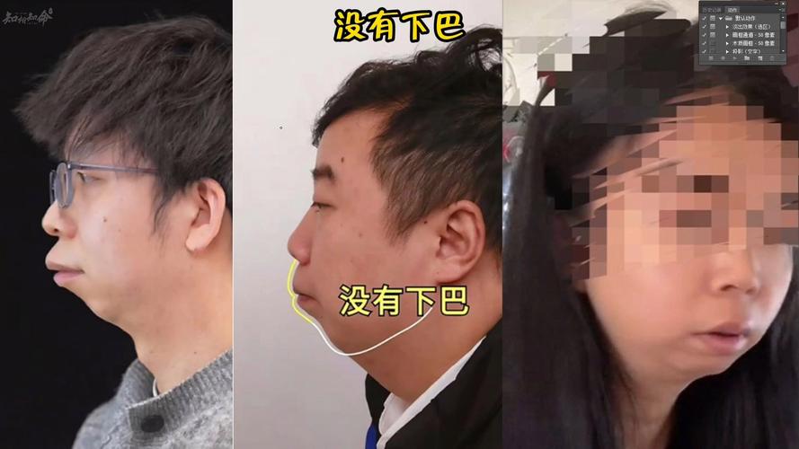 男人无下巴或短下巴面相命运如何？
