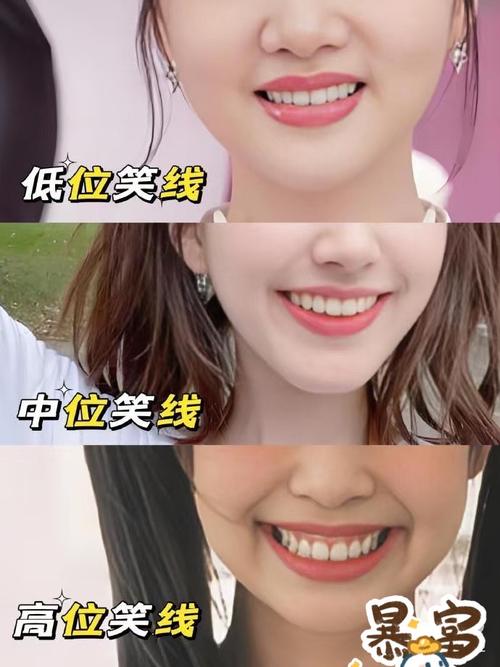 牙齿整齐洁白的人命运如何？面相有何特点？