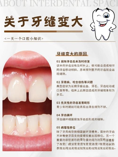 牙缝太大是否会影响风水，对女性来说有什么特别讲究？