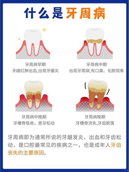 补牙后牙齿还是松动，这是不是意味着风水有问题？