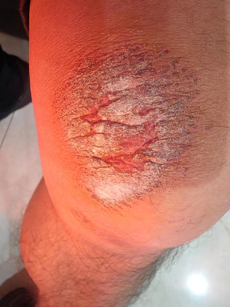 膝盖长毛是什么命理象征？膝盖长毛代表什么含义？