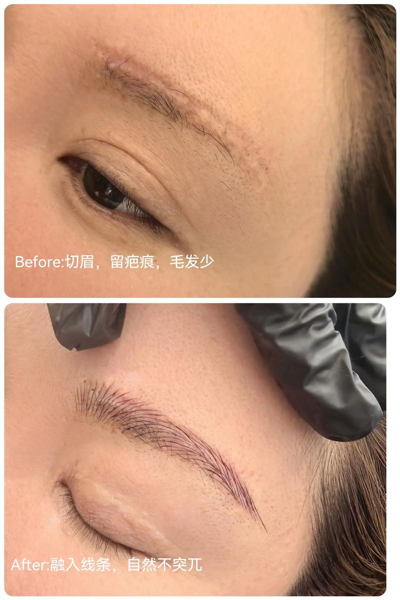 眉毛有刀口的女人命运如何，能否改变？