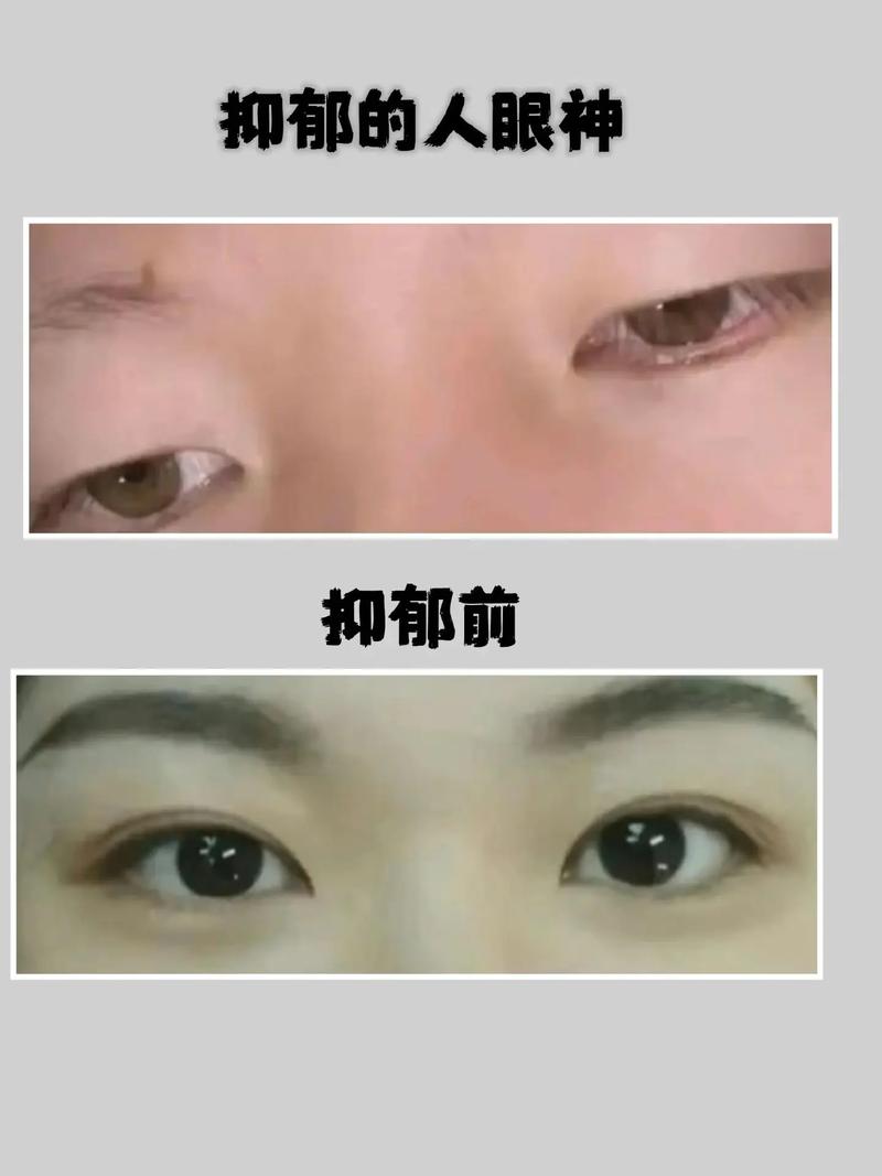 眼神无精打采的人命运如何？眼神呆滞无神是何命运所致？