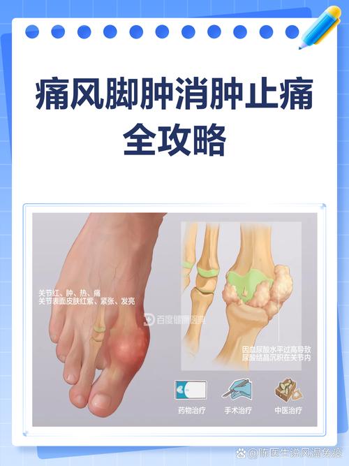 痛风水肿泡脚对缓解症状有显著效果吗？