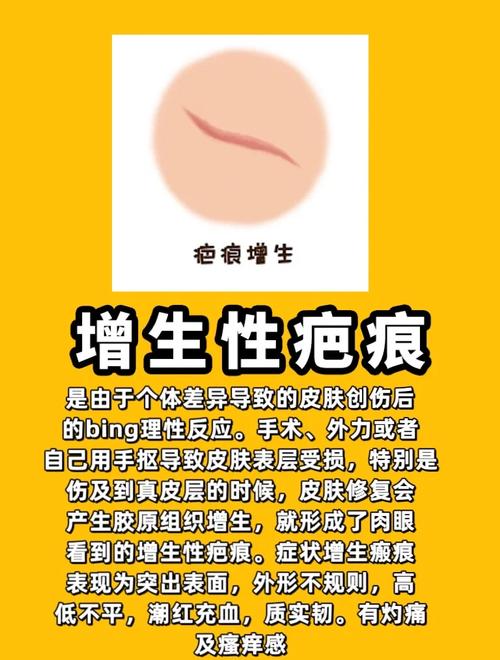 身上疤痕多，难道是前世留下了哪些痕迹的暗示？