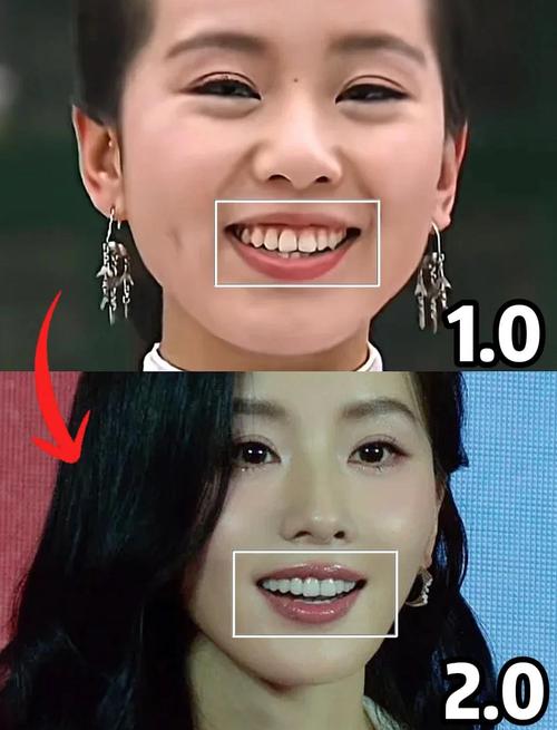 女人露齿门牙面相是什么命运？