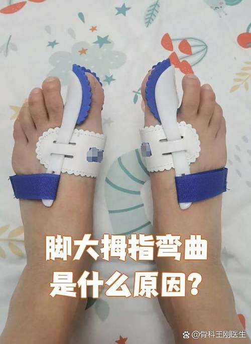 脚趾食指弯曲脚趾大拇指短是什么命？