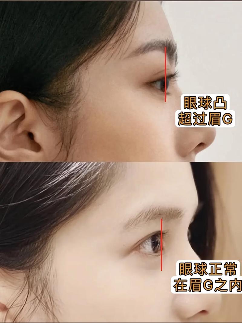 眼睛圆圆的人命运如何？眼睛凸出的女性命理是否可改？