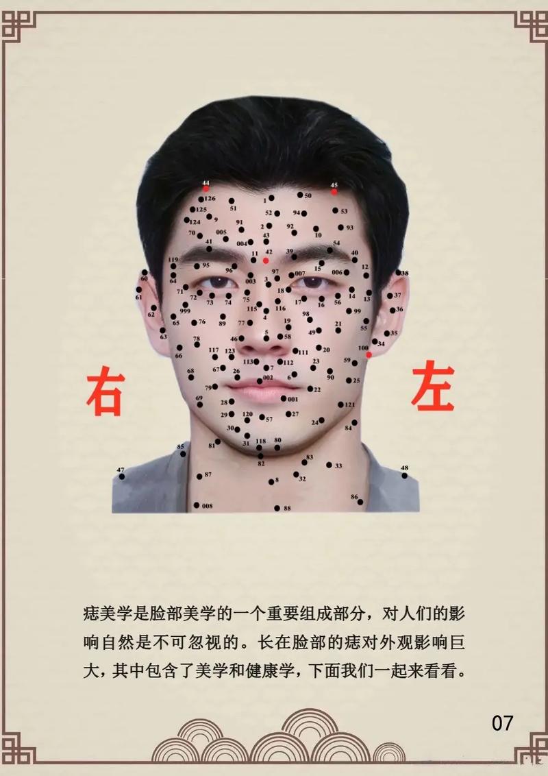 脸上有大黑痣，命运如何？预示着什么？