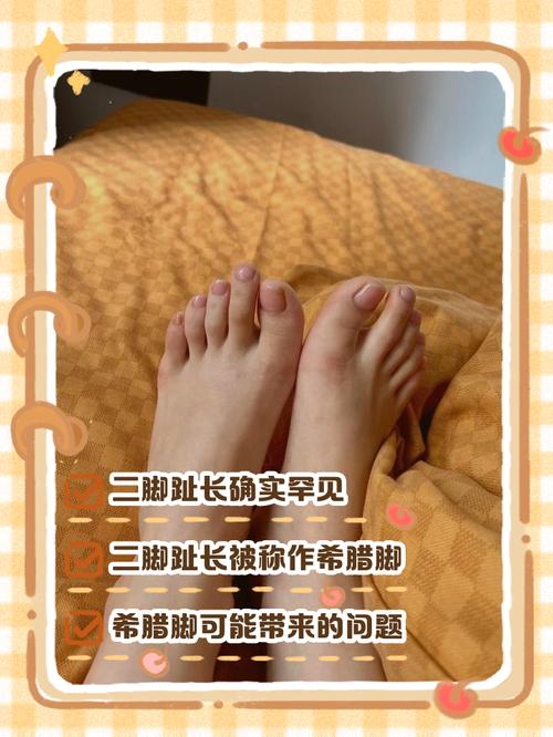 大脚趾和二脚趾一样长，这样的脚型命运如何？