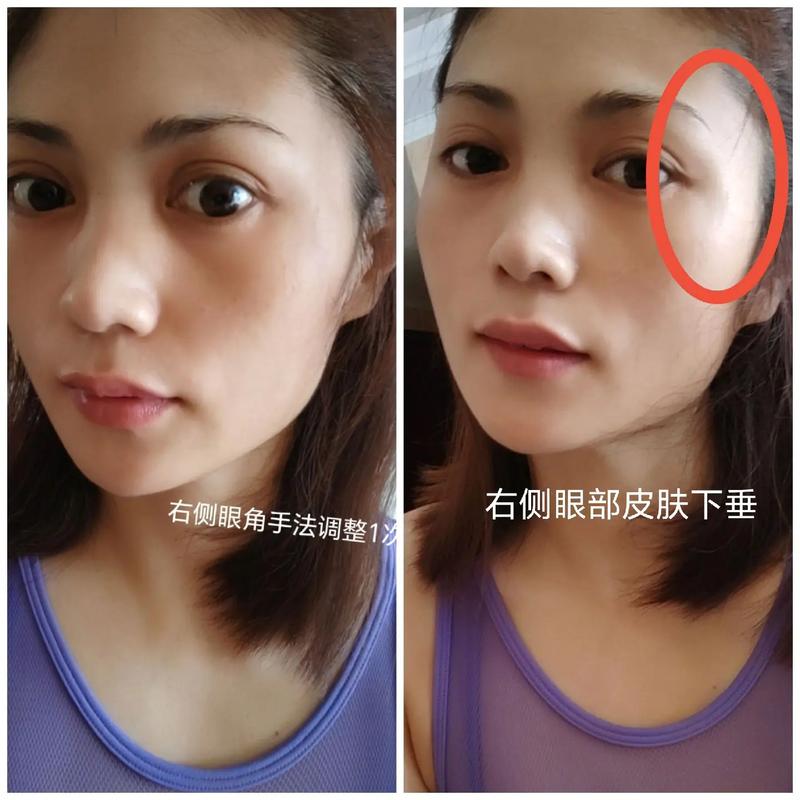 眼角外突眼角下垂的面相命运如何改写？