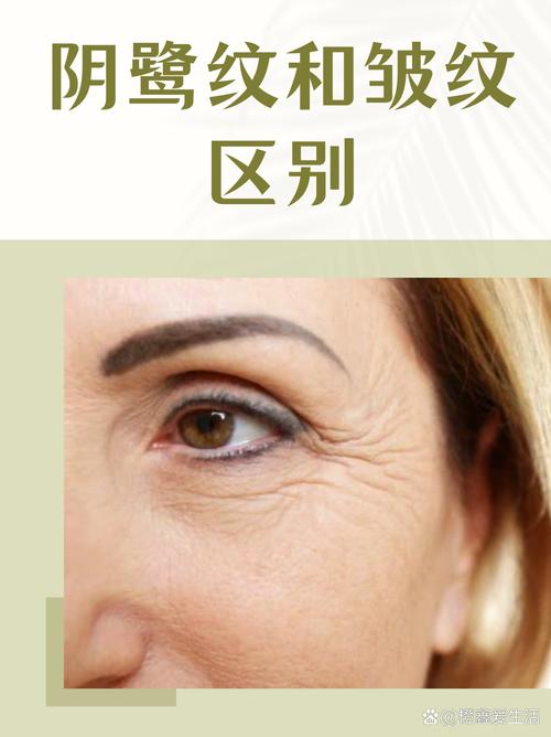 脸上皱纹多是否与风水学有关联？