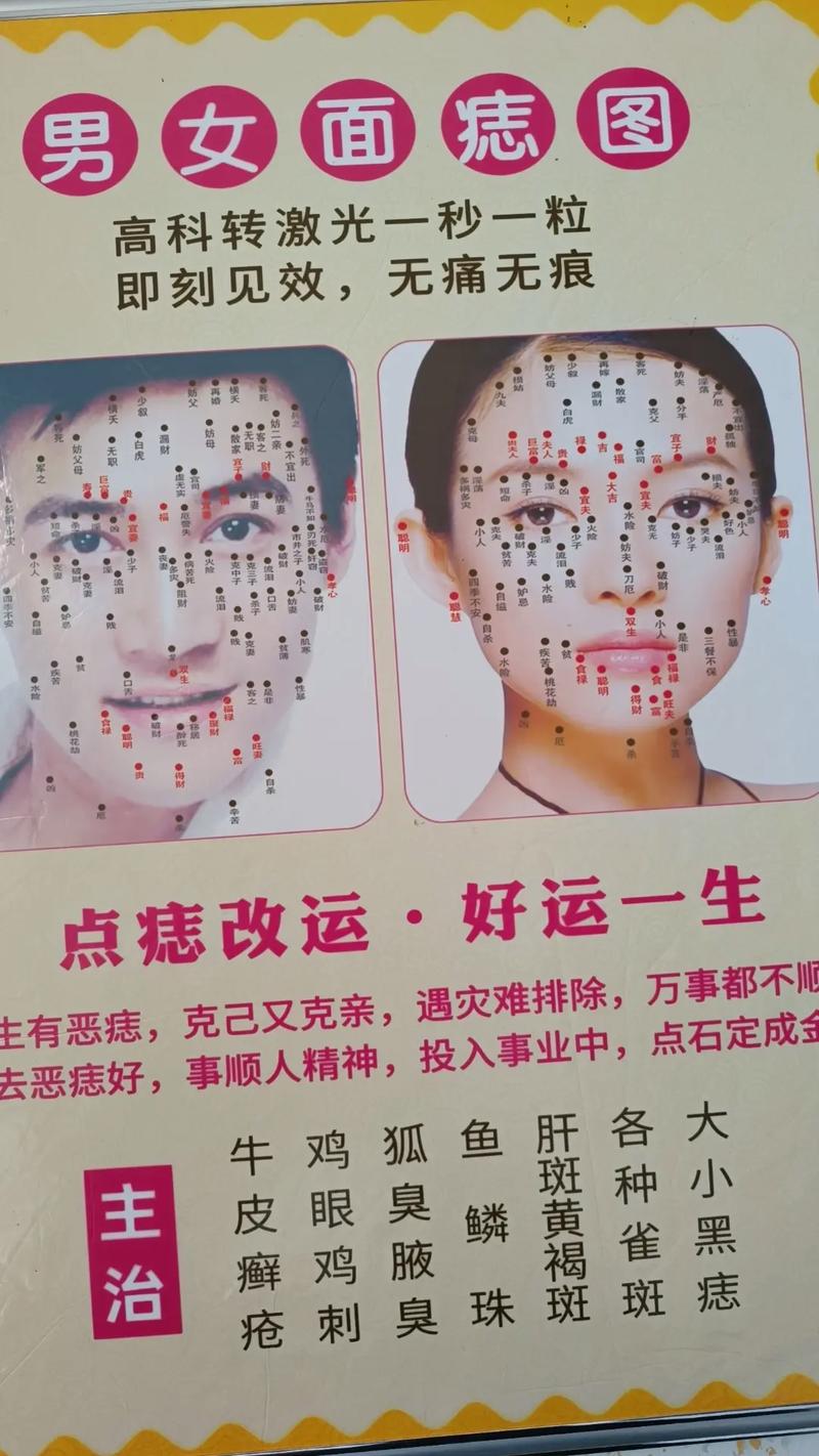 去掉身上的痣会影响家宅风水运势吗？