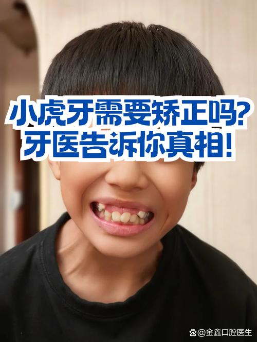 虎牙矫正会对家庭风水产生怎样的影响呢？