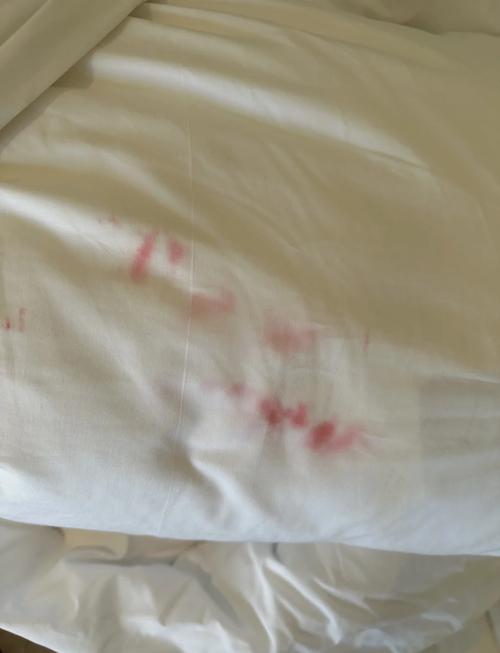 枕套沾染血迹会对家中的风水产生怎样的影响？