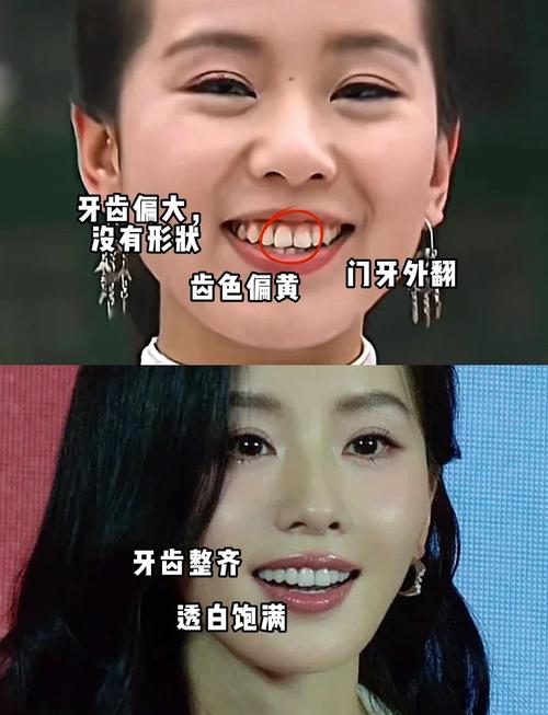 女人露齿门牙面相是什么命运？