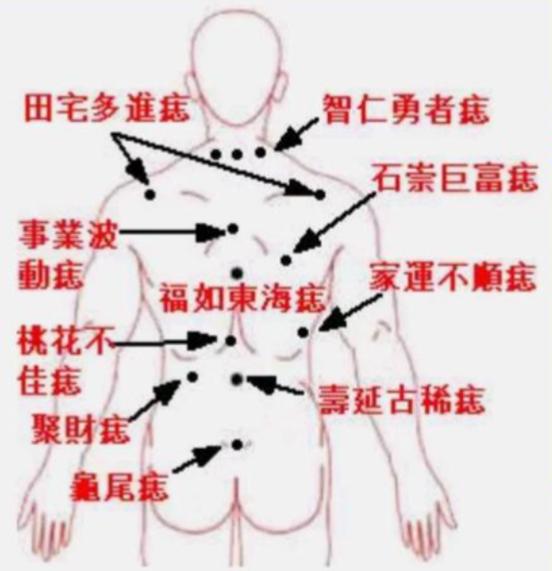 胸口长瘊子命运如何？虎口长瘊子有何象征意义？