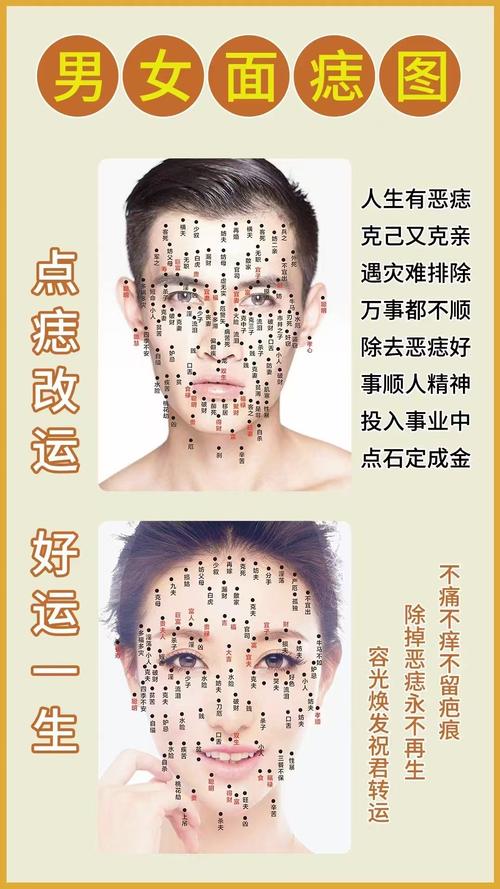 点痣时，究竟需不需要考虑风水问题呢？