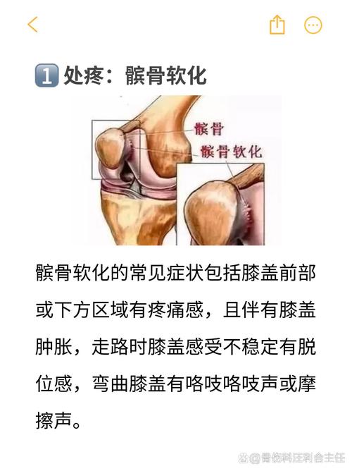 膝盖疼痛是否与家居风水布局存在关联？