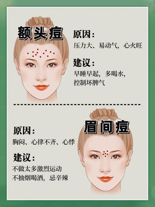 为什么有些人容易长痘痘，命运是否与长痘有关？