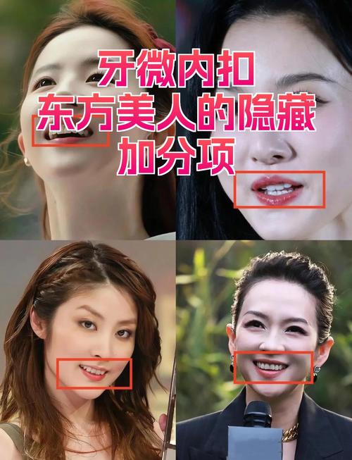 牙齿内扣的女人命运如何？牙齿内扣的特征是怎样的？
