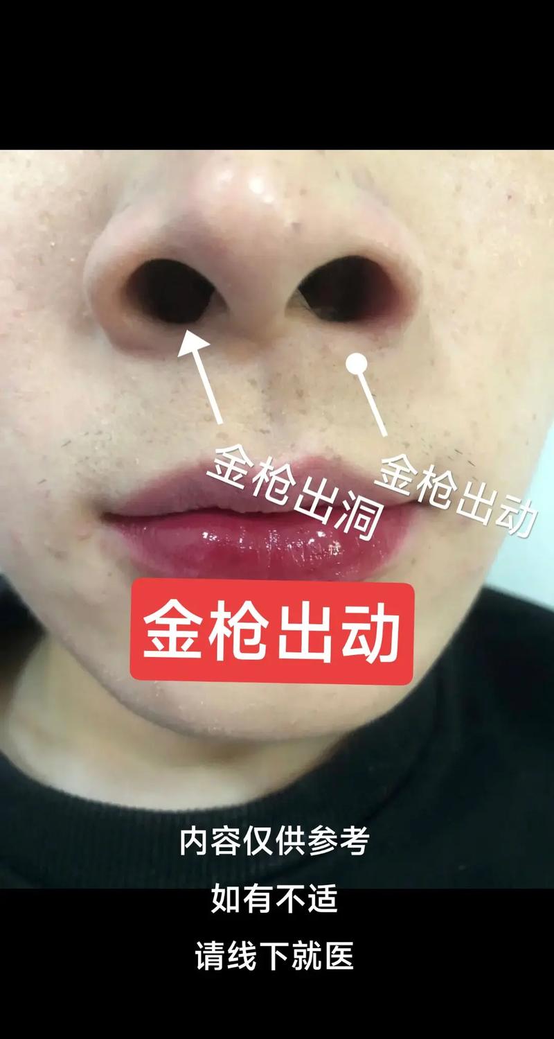 鼻孔大外露的命是否可依改变，命运如何？