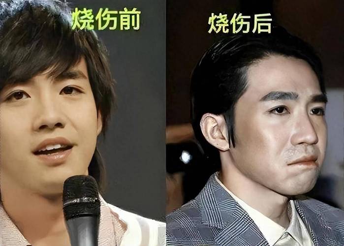 从小毁容的人命运如何？他们的生活会有哪些挑战？