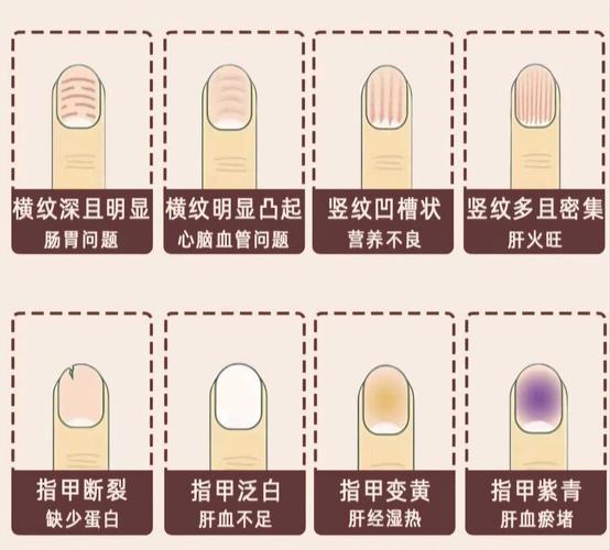 指甲硬度与命运有何关联？