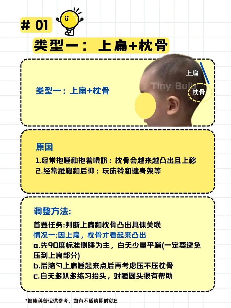 枕骨突出的人命运如何？