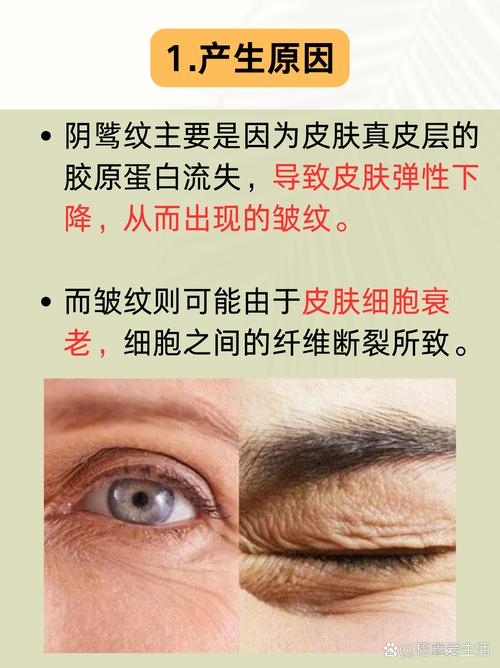 脸上皱纹多是否与风水学有关联？