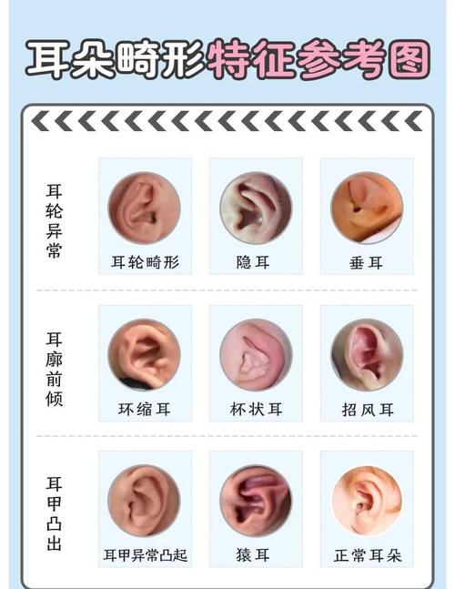 右耳下胎记和耳朵前胎记分别预示着怎样的命运？