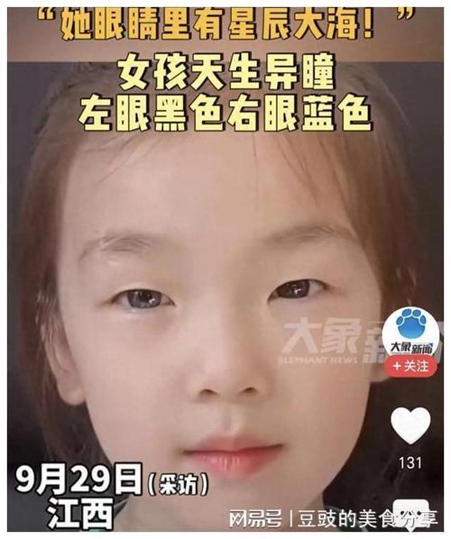 童子命的人眼部有哪些显著特征？