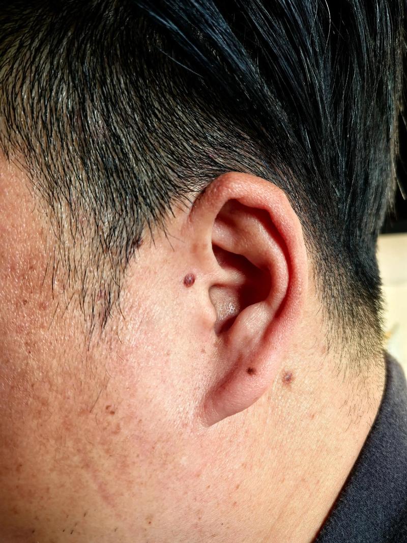 左耳垂长白汗毛预示着什么命运，一根白毛在左耳垂上是否意味着命运将有所改变？