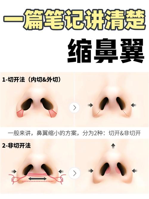 只缩鼻翼对风水有何具体影响？