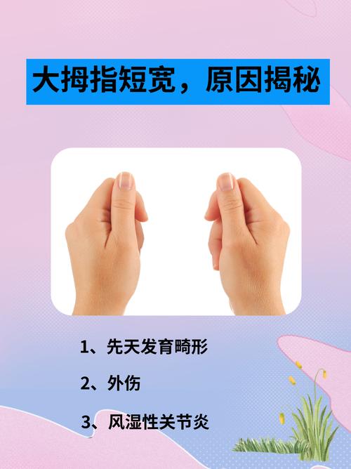 大拇指扁短的人命运如何？原因是什么？