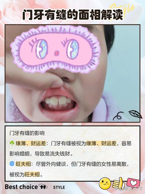 门牙豁口对家居风水有影响吗？