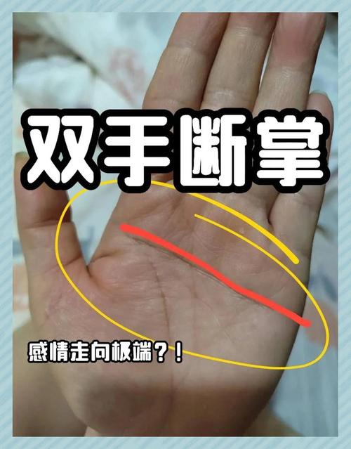 老公双手断掌，这命运会怎样改变呢？