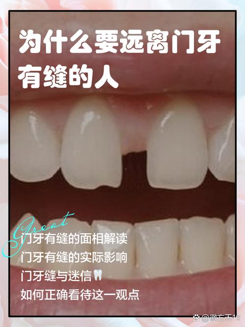 门牙豁口对家居风水有影响吗？