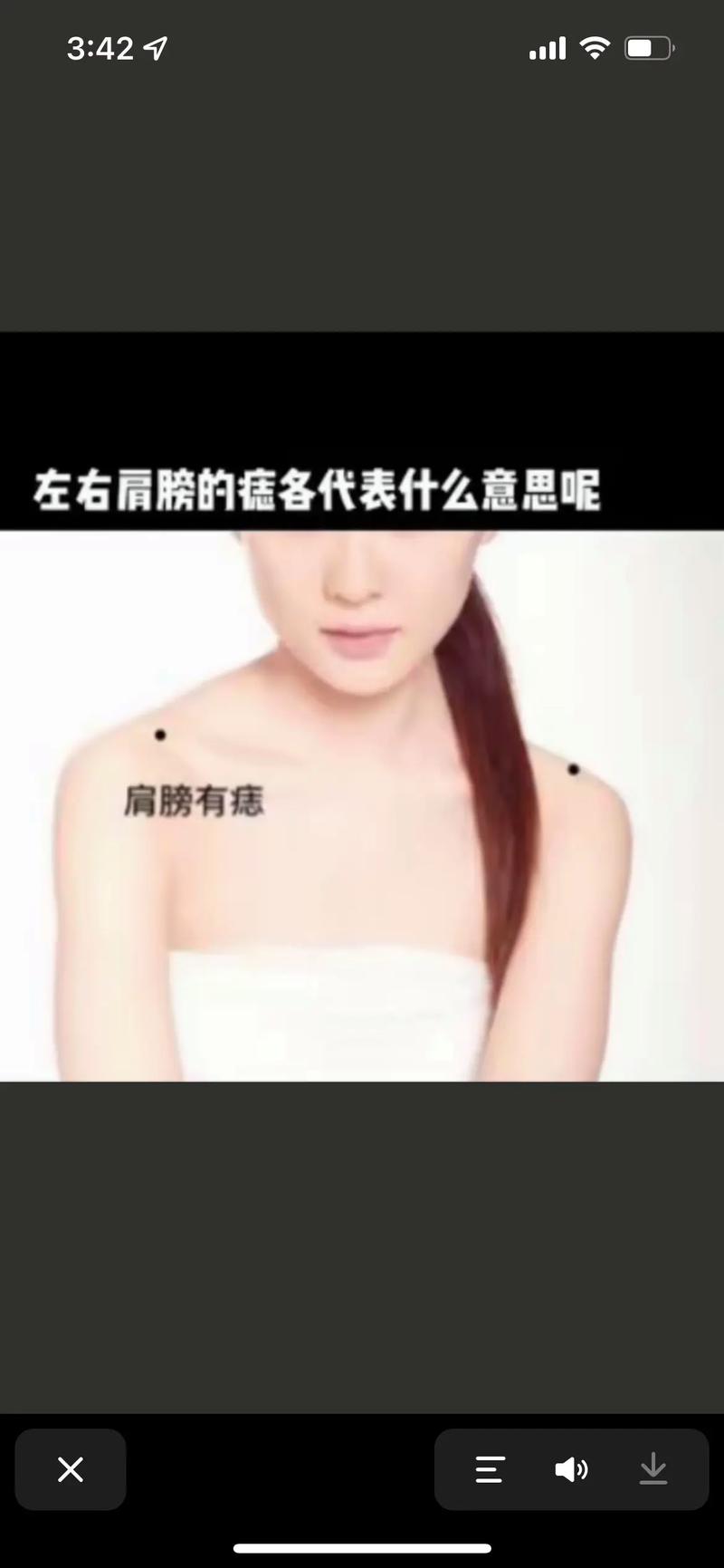 肩膀有志或有痣的人命运如何？吉凶如何？