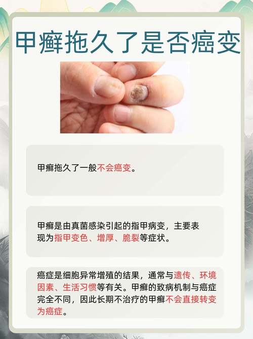 命毒命硬的人，指甲硬的命，到底好不好？