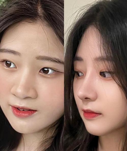 女人扁鼻子是什么命？鼻子扁塌的女人面相如何？