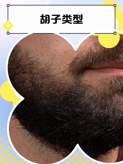 男人胡须少头发多是什么命？头发多胡须少的男人命运如何？