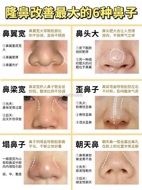 鼻子大长脸型，鼻翼宽鼻头大，这样的面相命运如何？