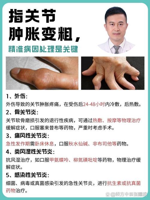 手指中间骨节细叫什么？男人手指骨节大是什么原因？