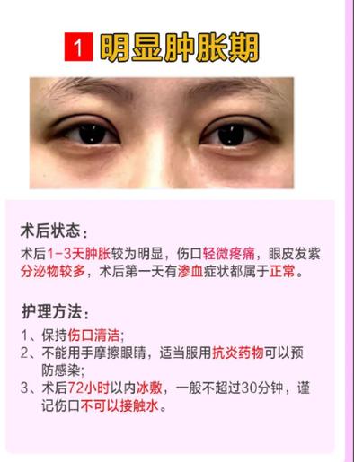 眼睛整容会对家居风水产生怎样的影响？