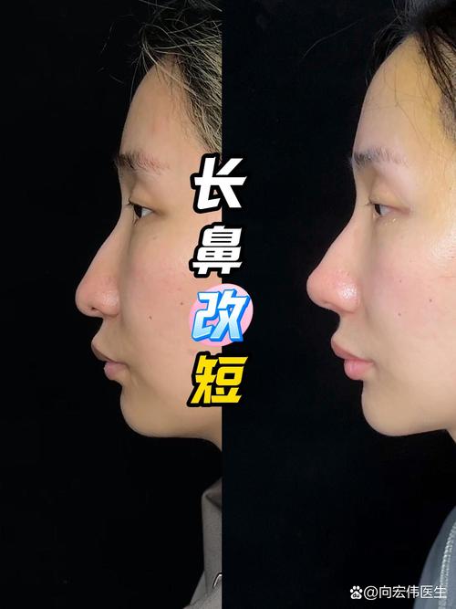 鼻子短的人命运如何？鼻子短大的女人面相如何改写为长面相？