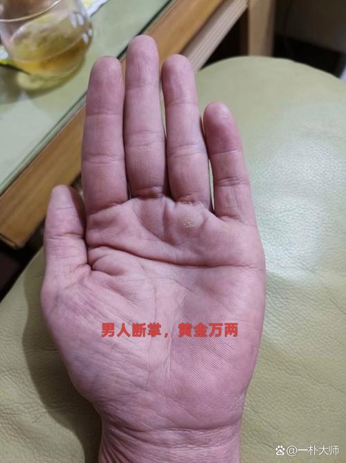 一个双臂断掌的男孩命运如何？